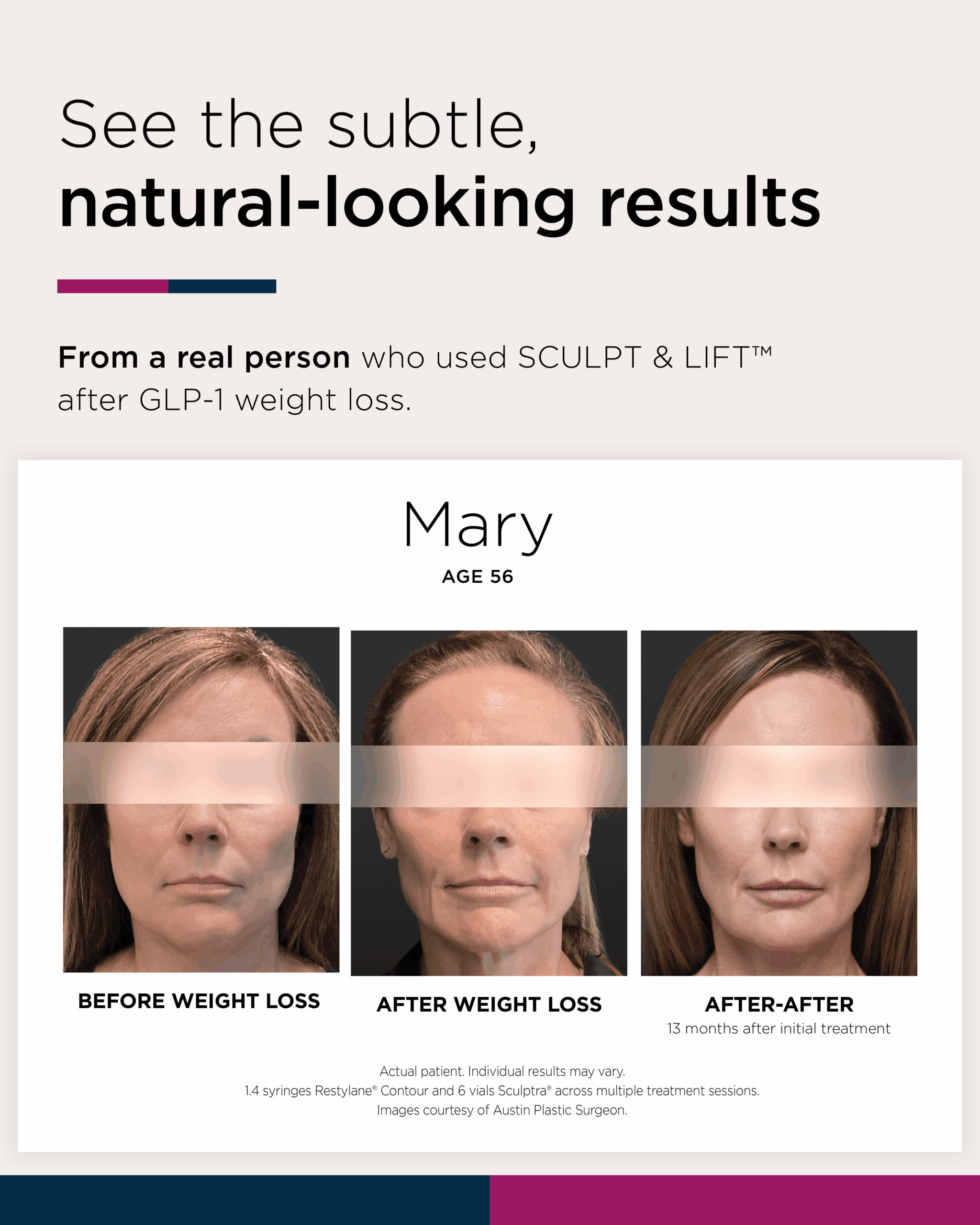 Frame 1 Mary Brown B&A